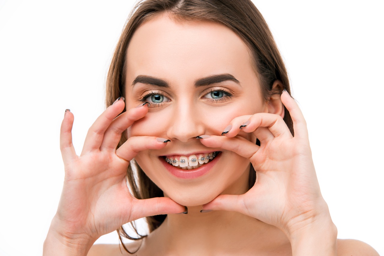 Preserva tu ortodoncia con retenedores fijos y removibles.